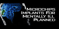 Microchips Implants For Mentally Ill Planned